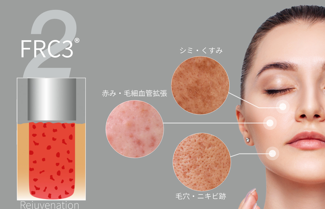 フラック3リジュビネーション