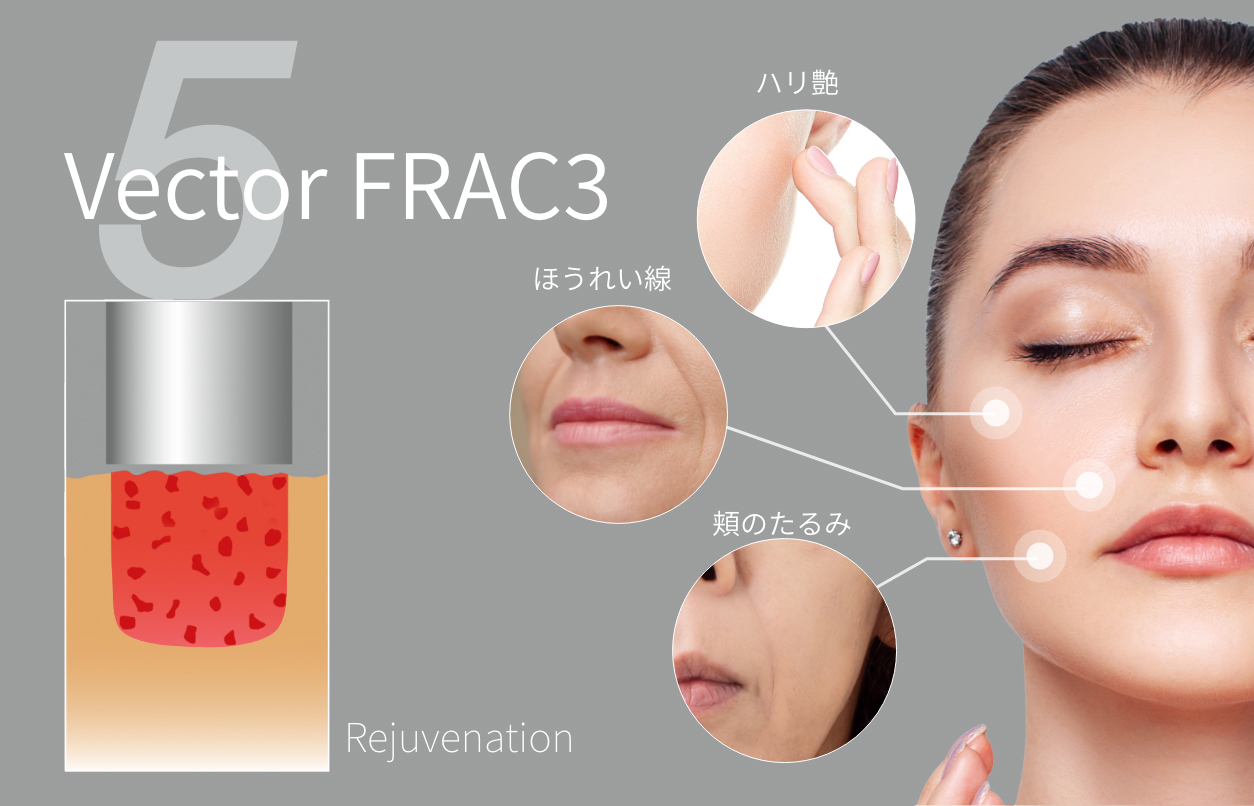 ベクターリフトアップモード