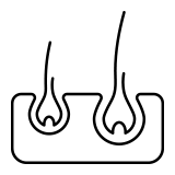 医療レーザー脱毛