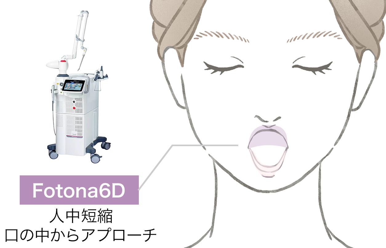 スムースリフトモード