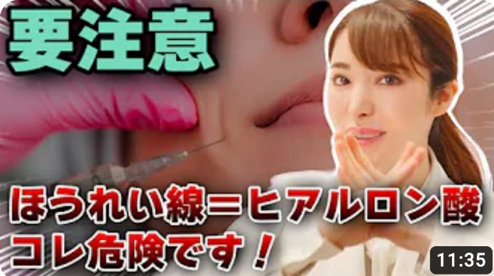 要注意！ほうれい線＝ヒアルロン酸、コレ危険です！