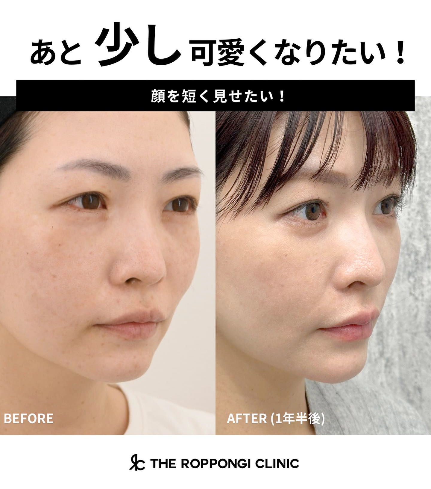 あと少し可愛くなりたい!顔を短く見せたい!
