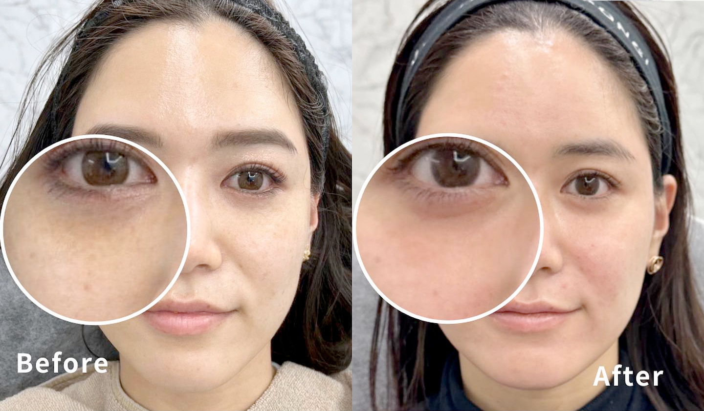 Dr沙也加手打ちスペシャルで肌にダイレクトに栄養を