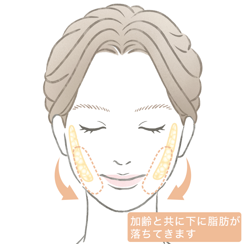 バッカルファット