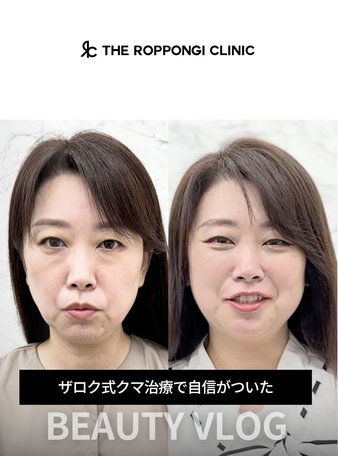 ザロク式クマ治療で自信がついた