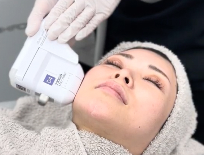 ダブロゴールド照射