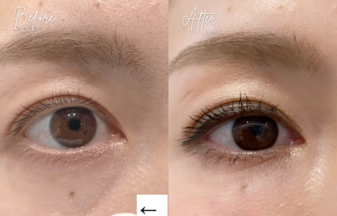 リジュランでお肌の自己再生を促し、根本から若返り