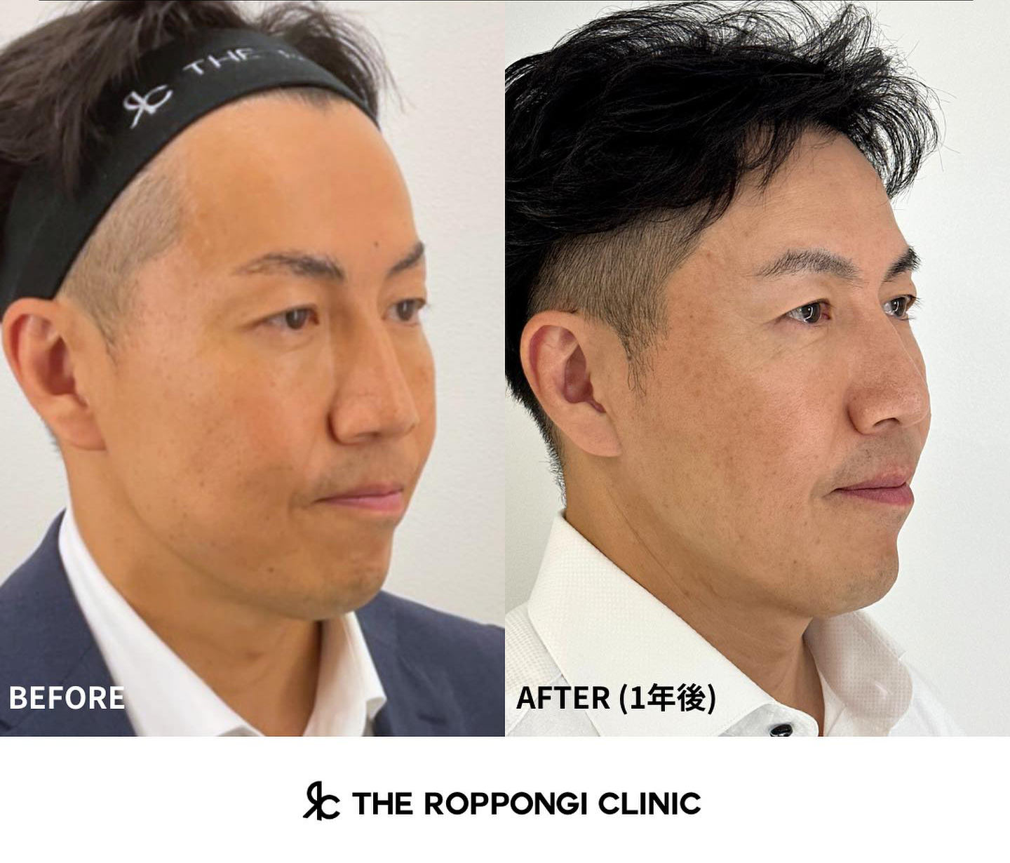 男性アンチエイジング