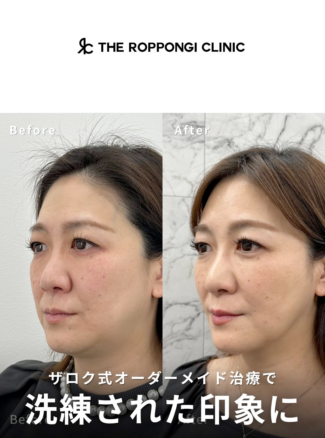 【ザロク式オーダーメイド】洗練された印象に