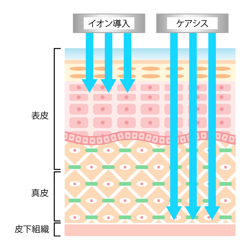ケアシスとイオン導入の違い