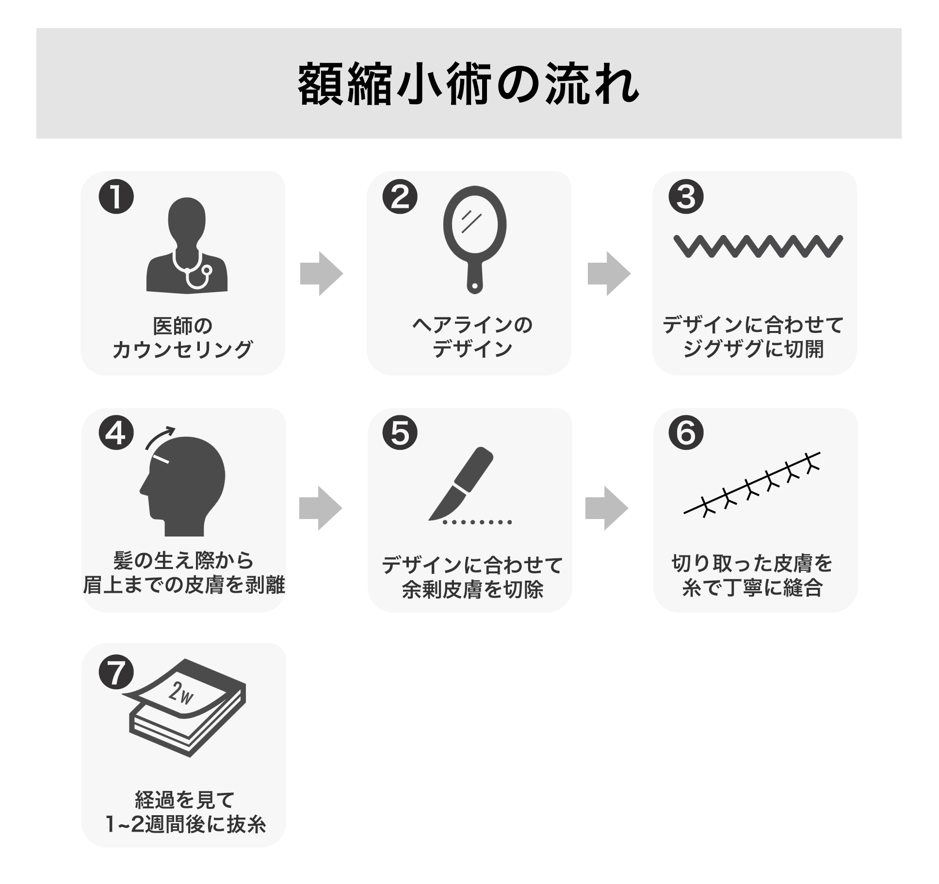 額縮小術の流れ