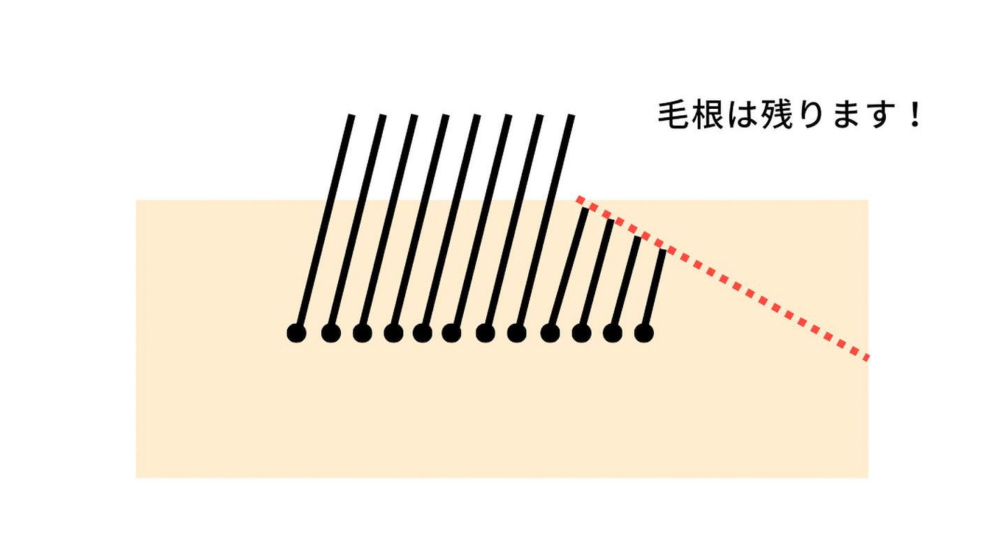 毛根は残ります