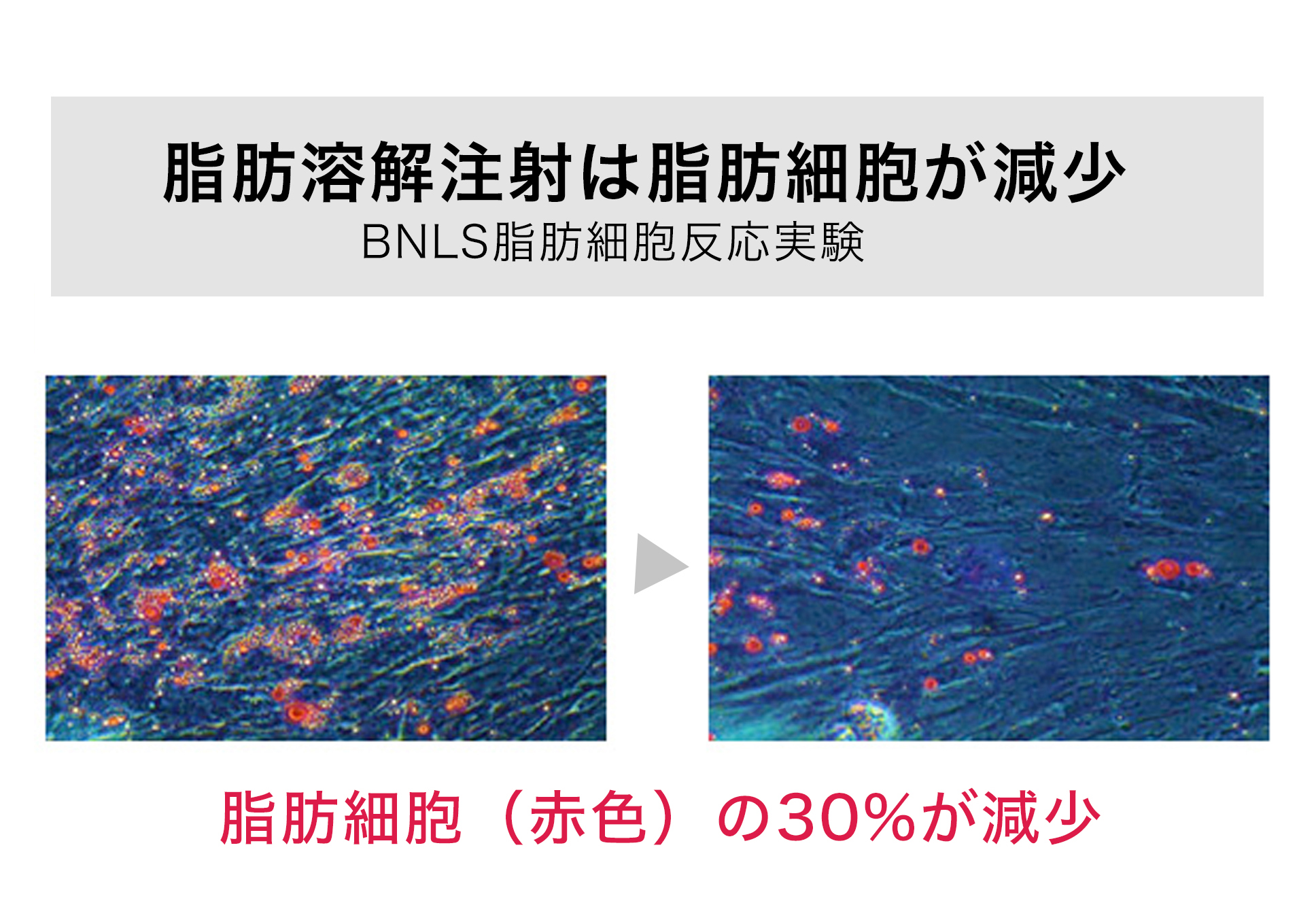 脂肪細胞は30%減少