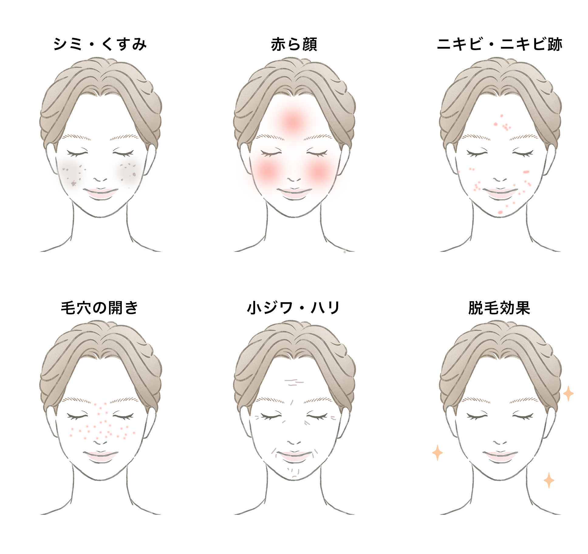 フォトフェイシャルM22