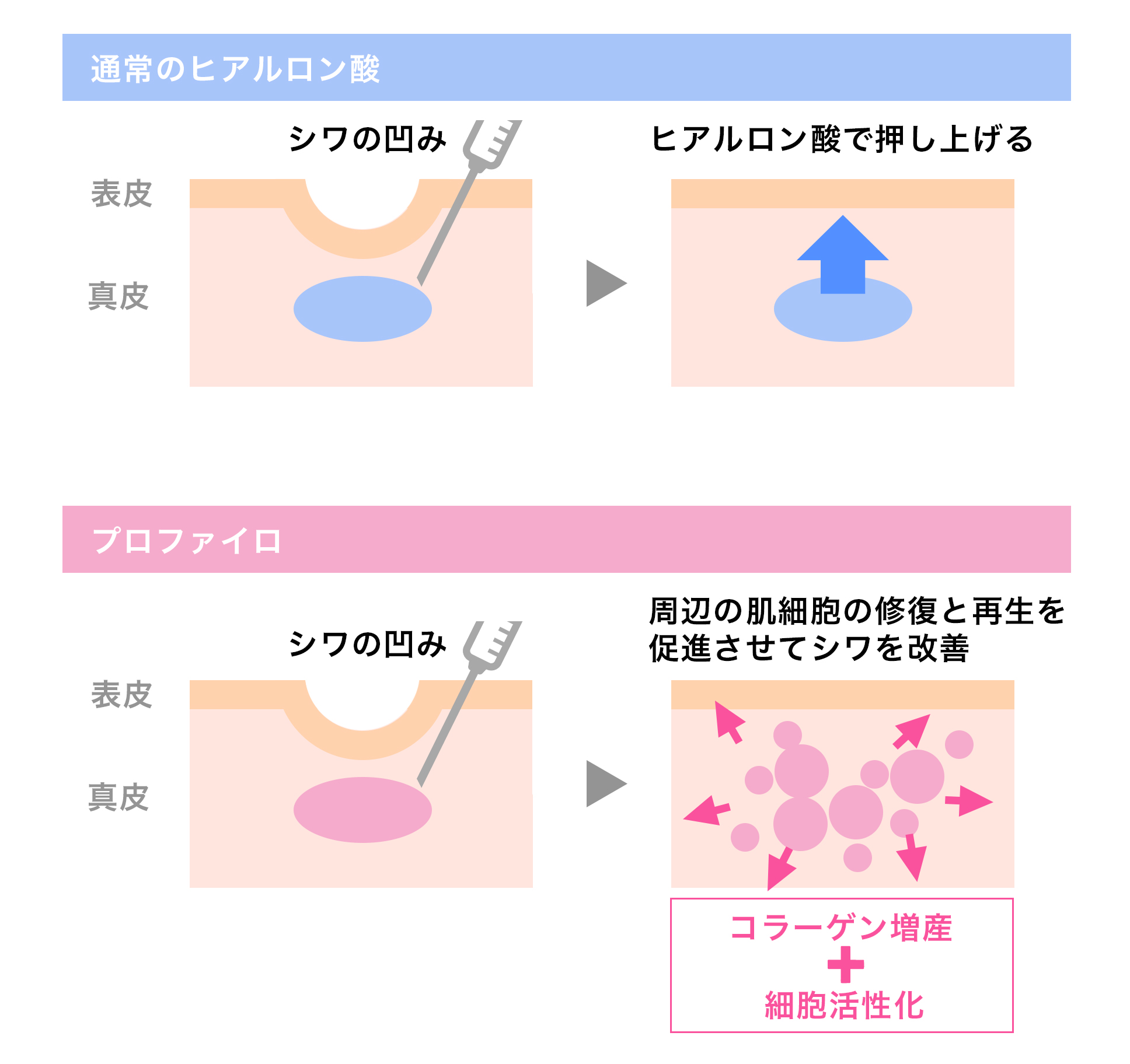 プロファイロの働き