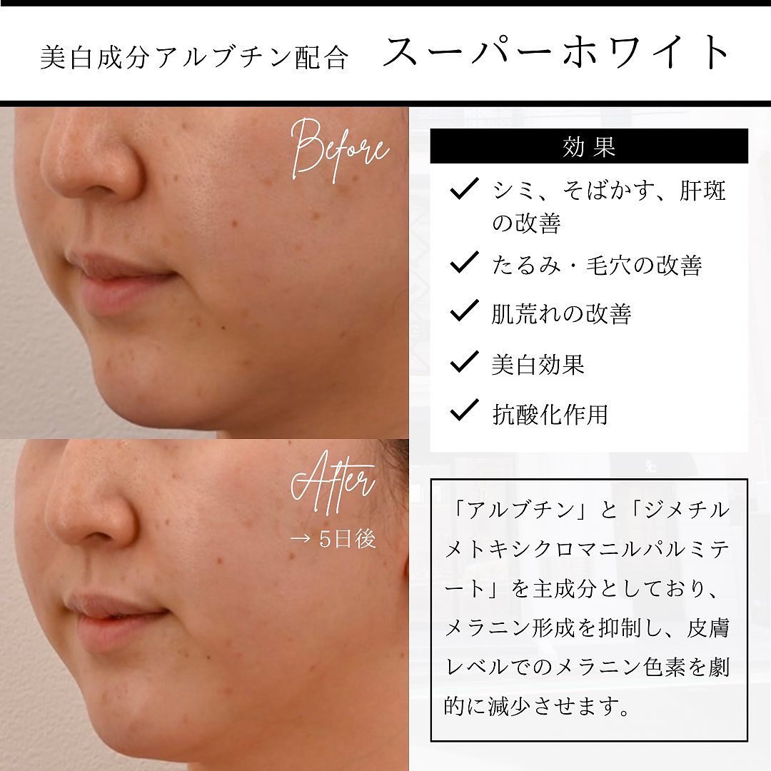 水光ショット(U225)