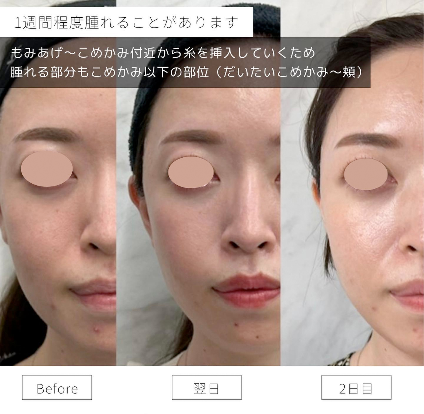 少ないダウンタイム