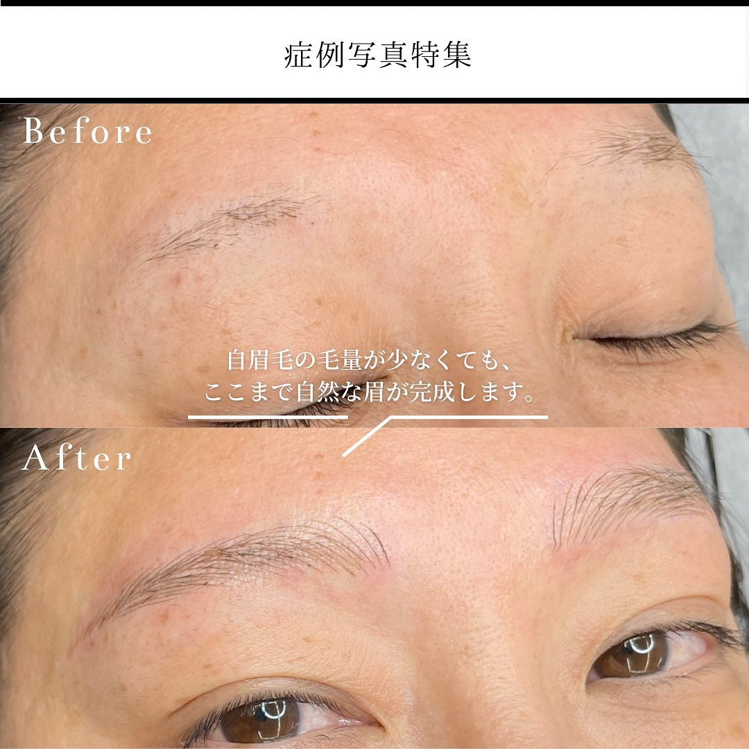 眉アートメイク