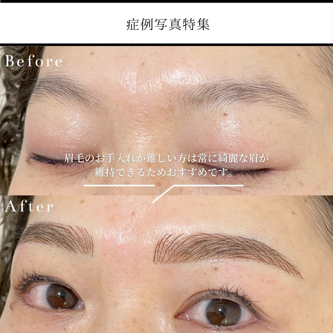 眉アートメイク