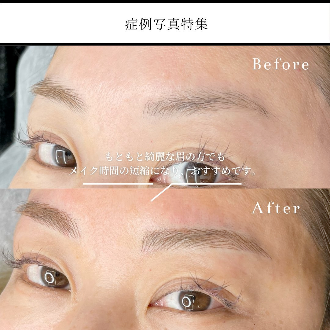眉アートメイク