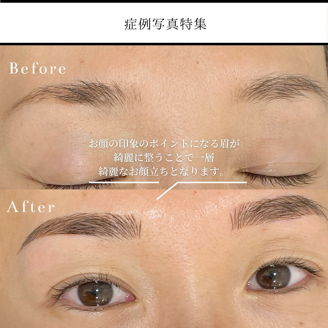 眉アートメイク