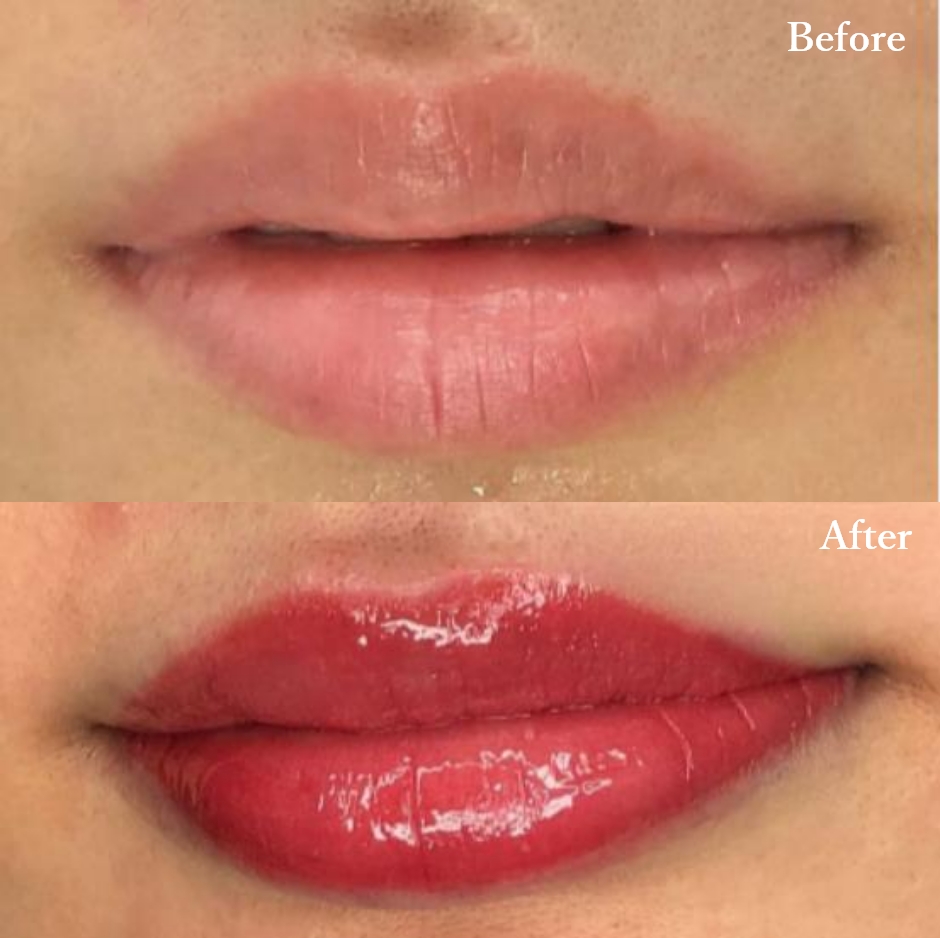 唇アートメイク