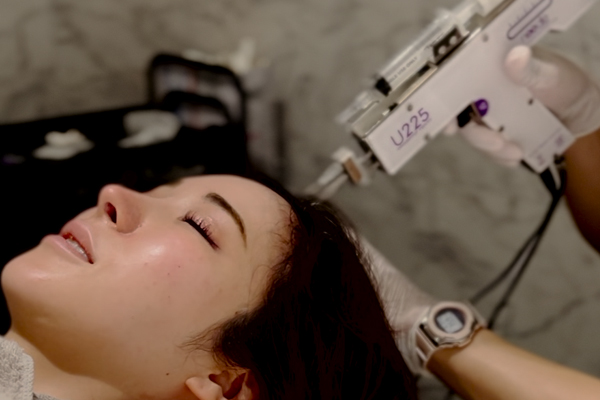 女性の薄毛治療