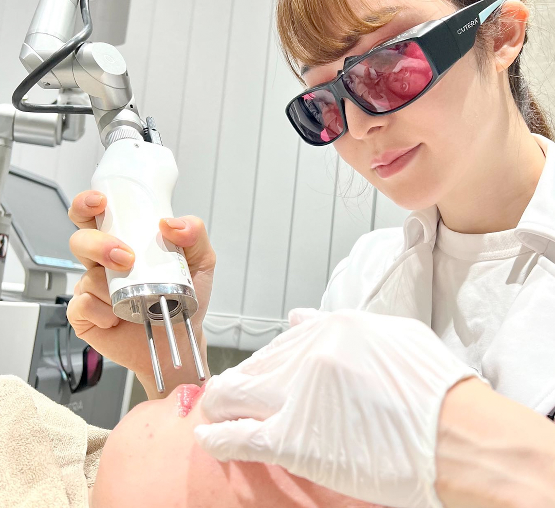 ウルトラピコ打ち放題